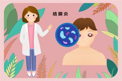 ​结膜炎有哪些症状（ 怎么判断是不是结膜炎）