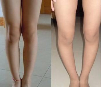 ​怎样才能使腿变直变细
