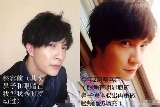 薛之谦整容对比照被曝光？薛之谦什么时候自曝做过微整？