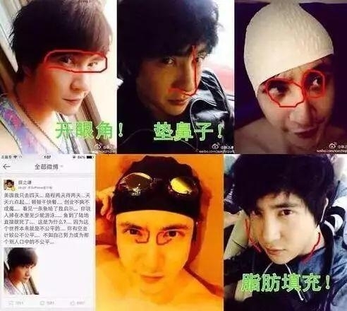 薛之谦整容对比照被曝光？薛之谦什么时候自曝做过微整？