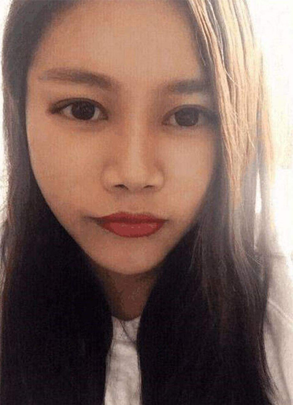 凤姐整容后照片