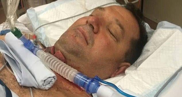 男子吃烧烤被牛排差点被牛排噎死，妻子立马拿刀割开丈夫喉咙