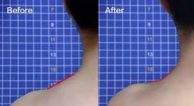 ​消除斜方肌的方法(背部斜方肌怎么锻炼)