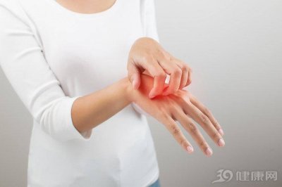 ​治疗湿疹药膏排行榜 湿疹皮肤专用治疗