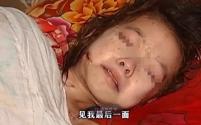 ​10岁女孩全身溃烂生蛆，亲生父亲却狠心拒见最后一面，结局怎样？